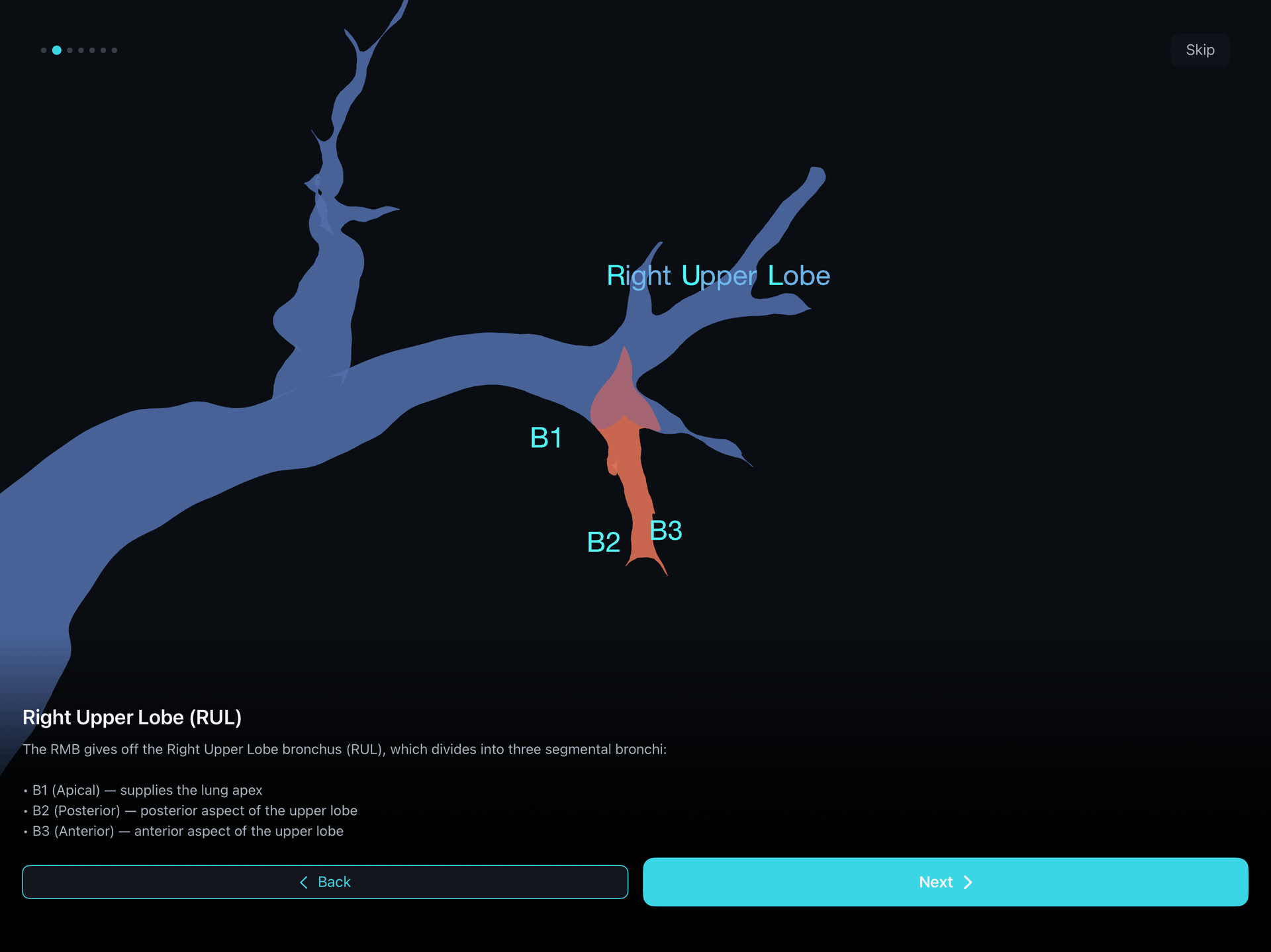 BronchoQuest スクリーンショット 1