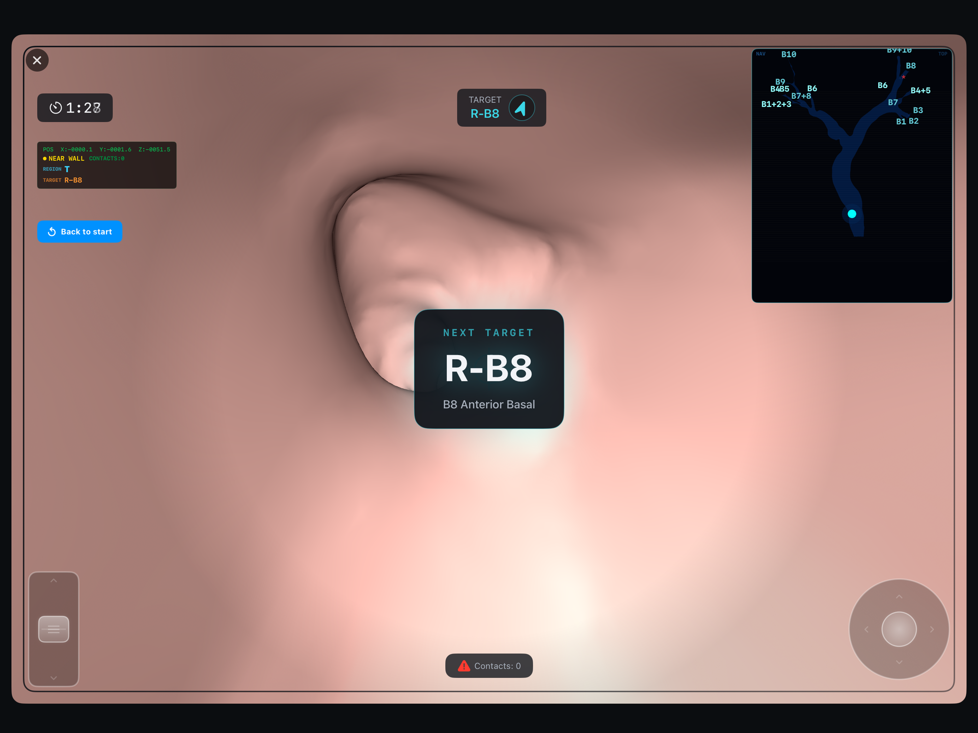 BronchoQuest スクリーンショット 2